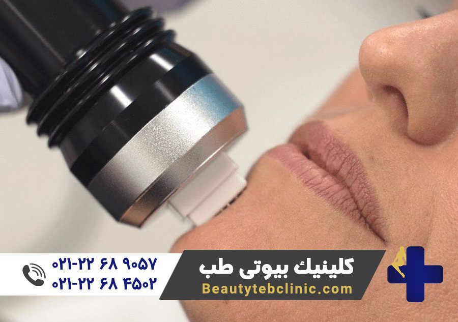 دستگاه لیزر پوست | لیزر پوست | لیزر موهای زائد | لیزر دایود | لیزر الکساندرایت | رفع موهای زائد | پزشک متخصص لیزر 