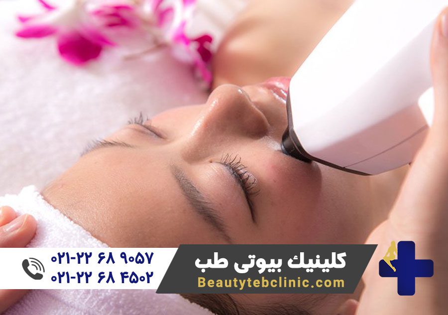 نکات مهم قبل از لیزر موهای زائد