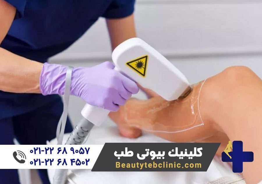 دستگاه لیزر پوست | لیزر پوست | لیزر موهای زائد | لیزر دایود | لیزر الکساندرایت | رفع موهای زائد | پزشک متخصص لیزر 