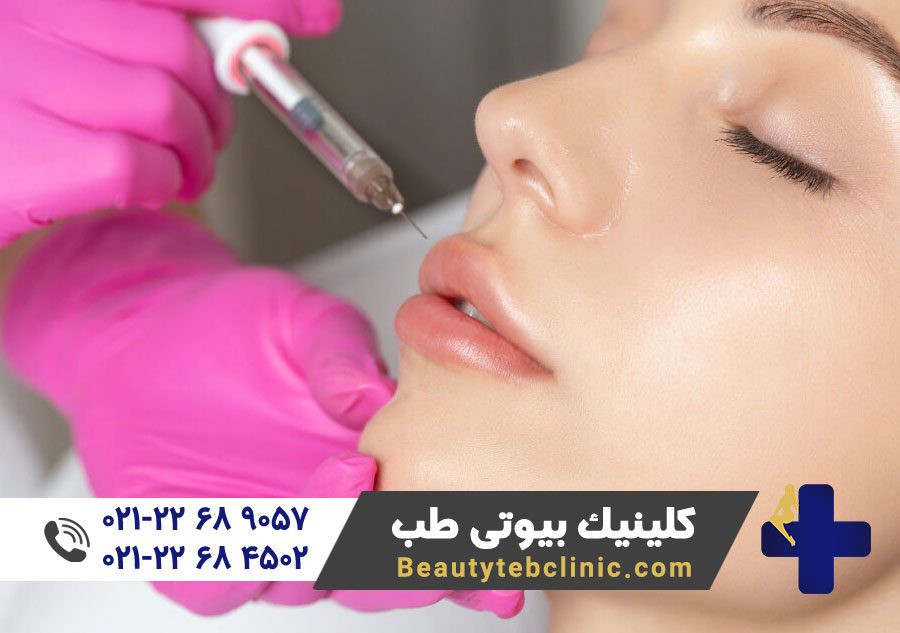 بوتاکس لب