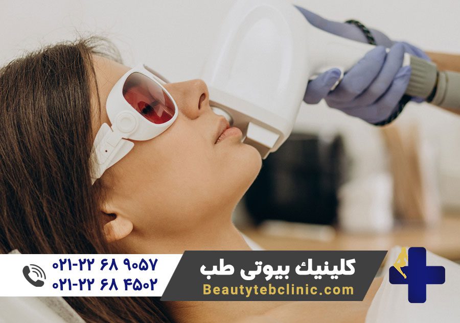 15 باید و نباید مهم لیزر موهای زائد 1 15 باید و نباید مهم لیزر موهای زائد