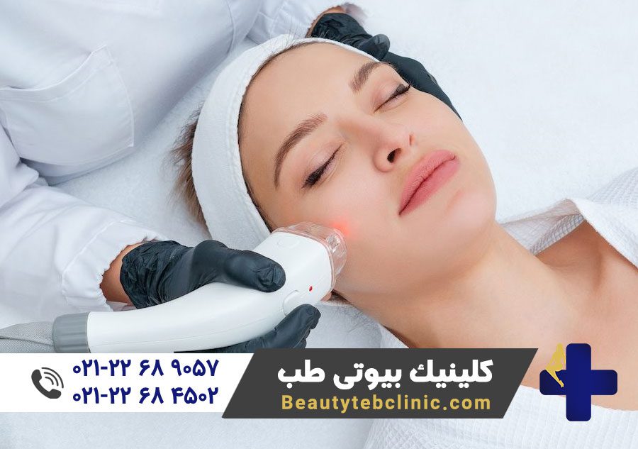 مراقبت های بعد از لیزر موهای زائد