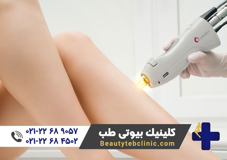 10 مزیت لیزر کندلا جنتل مکس پرو 4 Laser Candela Gentle Max Pro
