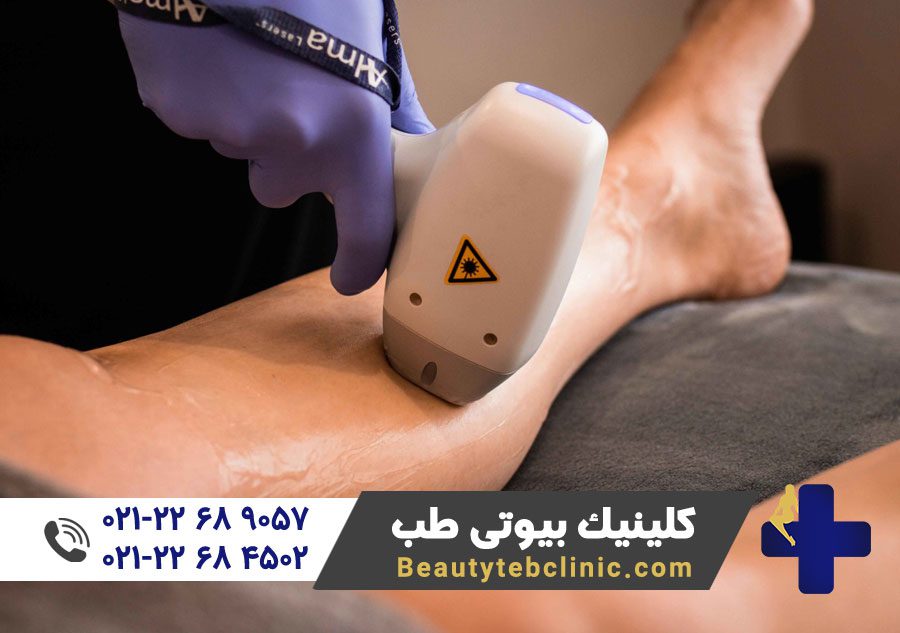 5 سوال متداول لیزر موهای زائد 8 عوارض لیزر موهای زائد | لیزر موهای زائد بدن | لیزر موهای زائد صورت | لیزر موهای زائد بیکینی | کلینیک لیزر و زیبایی | پزشک متخصص لیزر